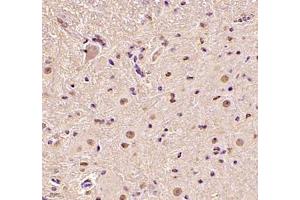 Immunohistochemistry of paraffin embedded mouse spinal cord using DDX19B (ABIN7073694) at dilution of 1: 1000 (400x lens)
