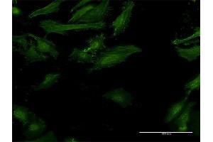 Immunofluorescence of monoclonal antibody to IFNGR2 on HeLa cell. (IFNGR2 antibody  (AA 28-127))