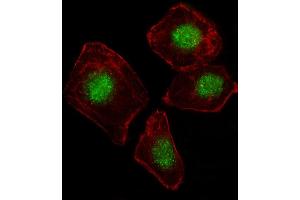 Fluorescent image of A549 cell stained with ZN Antibody (N-term) (ABIN1539171 and ABIN2849572). (ZNF187 antibody  (N-Term))