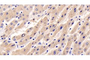 Immunohistochemistry (IHC) image for anti-Mitogen-Activated Protein Kinase 3 (MAPK3) (AA 75-312) antibody (ABIN7426271)