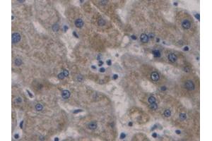 Used in DAB staining on fromalin fixed paraffin-embedded Liver tissue (Hepcidin antibody  (AA 25-84))