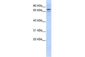 WB Suggested Anti-SEC23B Antibody Titration: 0. (Sec23 Homolog B antibody  (Middle Region))