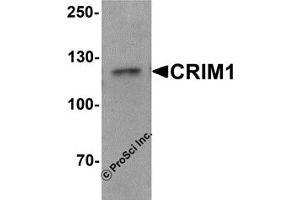Western Blotting (WB) image for anti-Cysteine Rich Transmembrane BMP Regulator 1 (Chordin-Like) (CRIM1) (C-Term) antibody (ABIN1030343)