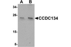 Western Blotting (WB) image for anti-Coiled-Coil Domain Containing 134 (CCDC134) (N-Term) antibody (ABIN1031302) (CCDC134 antibody  (N-Term))