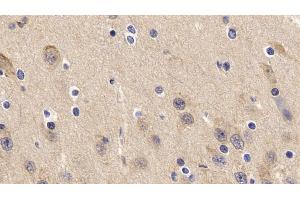 Detection of TNFa in Porcine Cerebrum Tissue using Polyclonal Antibody to Tumor Necrosis Factor Alpha (TNFa) (TNF alpha antibody  (AA 79-234))