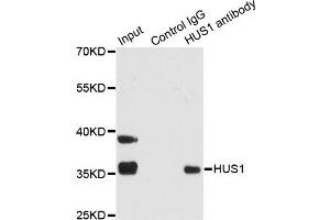 Immunoprecipitation analysis of 200ug extracts of 293T cells using 1ug HUS1 antibody (ABIN1876595). (HUS1 antibody)