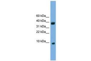 Image no. 1 for anti-Ribosomal Protein S21 (RPS21) (C-Term) antibody (ABIN6745111) (RPS21 antibody  (C-Term))