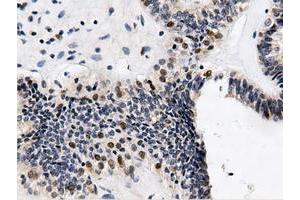 Immunohistochemical staining of paraffin-embedded Human Kidney tissue using anti-QPRT mouse monoclonal antibody. (QPRT antibody)