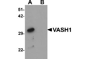 Western blot analysis of VASH1 in human brain tissue lysate with VASH1 antibody at 1 µg/mL in (A) the absence and (B) the presence of blocking peptide. (VASH1 antibody  (C-Term))