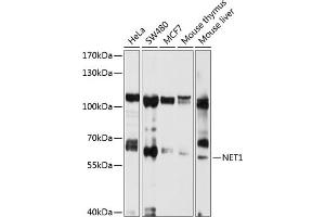 Western blot analysis of extracts of various cell lines, using NET1 antibody (ABIN3021741, ABIN3021742, ABIN1513253 and ABIN6215710) at 1:1000 dilution. (NET1 antibody  (AA 1-300))