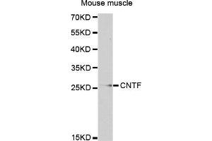 CNTF antibody  (AA 1-200)