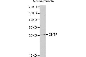 Western Blotting (WB) image for anti-Ciliary Neurotrophic Factor (CNTF) (AA 1-200) antibody (ABIN3015705) (CNTF antibody  (AA 1-200))