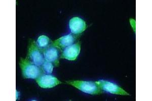 ICC/IF analysis of PSMA in LNCaP cells line, stained with DAPI (Blue) for nucleus staining and monoclonal anti-human PSMA antibody (1:100) with goat anti-mouse IgG-Alexa fluor 488 conjugate (Green). (PSMA antibody  (AA 117-351))
