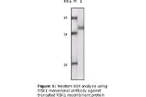 Western Blotting (WB) image for anti-Ribosomal Protein S6 Kinase, 90kDa, Polypeptide 1 (RPS6KA1) (truncated) antibody (ABIN2464100) (RPS6KA1 antibody  (truncated))