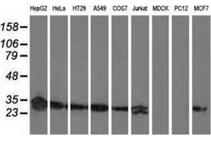 Western blot analysis of extracts (35 µg) from 9 different cell lines by using anti-SPR monoclonal antibody. (SPR antibody)