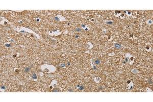 Immunohistochemistry of paraffin-embedded Human brain using PIP4K2A Polyclonal Antibody at dilution of 1:40 (PIP4K2A antibody)