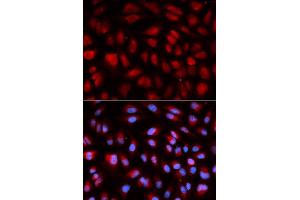 Immunofluorescence analysis of U2OS cell using PLK1 antibody. (PLK1 antibody  (AA 304-603))