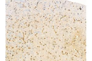ABIN6255261 and ABIN6267114 at 1/100 staining Rat brain tissue by IHC-P. (EEF2K antibody  (pSer366))