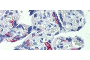 Human placenta; Anti-ZNF71 antibody IHC staining of human placenta.