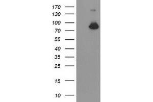 Western Blotting (WB) image for anti-Acyl-CoA Synthetase Short-Chain Family Member 2 (ACSS2) antibody (ABIN1496429) (ACSS2 antibody)