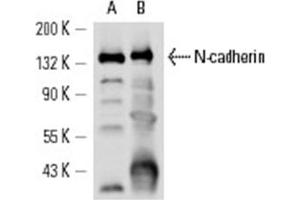 Image no. 1 for anti-Cadherin 2 (CDH2) antibody (ABIN272296) (N-Cadherin antibody)