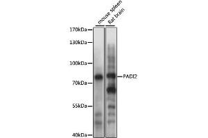 Western blot analysis of extracts of various cell lines, using PADI2 antibody (ABIN4904665) at 1:1000 dilution.