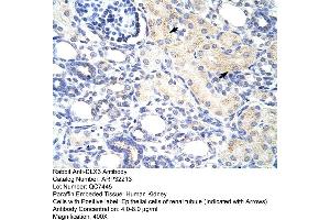 Rabbit Anti-DLX3 Antibody  Paraffin Embedded Tissue: Human Kidney Cellular Data: Epithelial cells of renal tubule Antibody Concentration: 4. (DLX3 antibody  (N-Term))