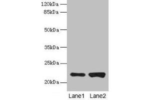 Western blot All lanes: CDC42 antibody at 6 μg/mL Lane 1: Hela whole cell lysate Lane 2: Jurkat whole cell lysate Secondary Goat polyclonal to rabbit IgG at 1/10000 dilution Predicted band size: 22 kDa Observed band size: 22 kDa (CDC42 antibody  (AA 2-188))