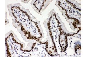 Immunohistochemistry (IHC) image for anti-Nucleophosmin (Nucleolar phosphoprotein B23, Numatrin) (NPM1) (AA 1-294) antibody (ABIN3042497)