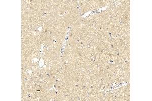 IHC analysis of UBE3A using anti-UBE3A antibody (ABIN7599562). (ube3a antibody  (AA 1-860))