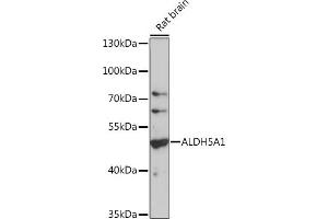 Western blot analysis of extracts of rat brain, using  antibody (6074) at 1:1000 dilution. (ALDH5A1 antibody  (AA 400-500))