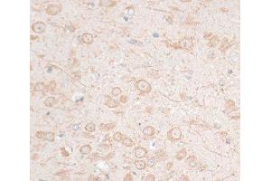 Immunohistochemistry of paraffin-embedded Mouse brain using HMGA1 Polyclonal Antibody at dilution of 1:100 (40x lens). (HMGA1 antibody)