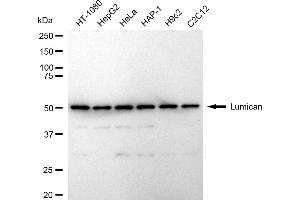 Western blotting analysis using Lumican antibody (ABIN7799286).