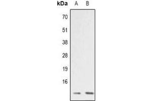 Western blot analysis of ATP5I expression in RT4 (A), COLO205 (B) whole cell lysates. (ATP5I antibody)