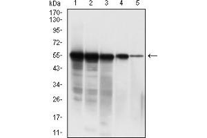 Western blot analysis using SARS-CoV-2-NP3 mAb against human SARS-CoV-2-N (AA: 1-419) recombinant protein. (SARS-CoV-2-NP3 (AA 240-419) antibody)
