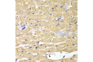Immunohistochemistry of paraffin-embedded mouse heart using HAX1 antibody.