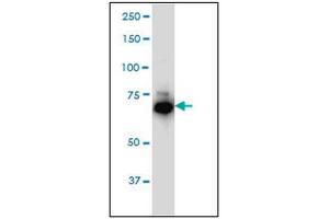 Western Blotting (WB) image for anti-Interleukin-1 Receptor-Associated Kinase 1 (IRAK1) (AA 530-693) antibody (ABIN614625) (IRAK1 antibody  (AA 530-693))