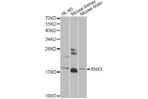 Western blot analysis of extracts of various cell lines, using SNX3 antibody (ABIN6290935) at 1:1000 dilution. (Sorting Nexin 3 antibody)
