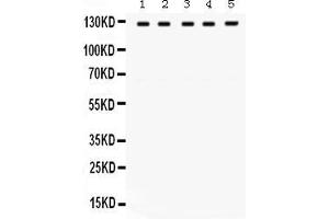 Anti- TRPM8 Picoband antibody, Western blottingAll lanes: Anti TRPM8  at 0. (TRPM8 antibody  (C-Term))