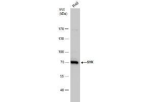 WB Image SYK antibody detects SYK protein by western blot analysis. (SYK antibody  (Internal Region))