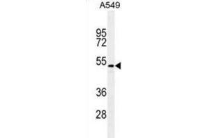 Western Blotting (WB) image for anti-Transforming Growth Factor, beta 2 (TGFB2) antibody (ABIN2995350)