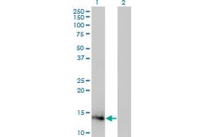 Western Blot analysis of IL2 expression in transfected 293T cell line by IL2 monoclonal antibody (M12), clone 1C1. (IL-2 antibody  (AA 21-153))