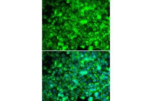 Immunofluorescence analysis of U20S cell using ADIPOR1 antibody. (Adiponectin Receptor 1 antibody  (AA 1-136))