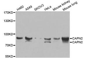 Western blot analysis of extracts of various cell lines, using CAPN2 antibody. (Calpain 2 antibody)