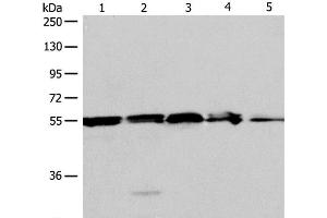 Western Blot analysis of A375, 293T cell and Mouse liver tissue, Jurkat cell and Human fetal kidney tissue using NAMPT Polyclonal Antibody at dilution of 1:700 (NAMPT antibody)