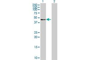 Western Blot analysis of KRT20 expression in transfected 293T cell line by KRT20 MaxPab polyclonal antibody. (KRT20 antibody  (AA 1-424))