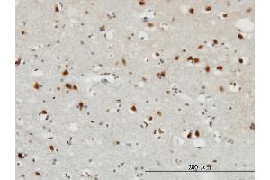 Immunoperoxidase of monoclonal antibody to FGF12 on formalin-fixed paraffin-embedded human cerebral cortex.
