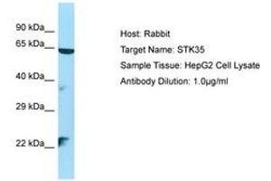 Image no. 1 for anti-Serine/threonine Kinase 35 (STK35) (AA 106-155) antibody (ABIN6750141) (STK35 antibody  (AA 106-155))