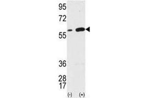 Western blot analysis of VIM antibody and 293 cell lysate (2 ug/lane) either nontransfected (Lane 1) or transiently transfected with the VIM gene (2). (Vimentin antibody  (AA 152-181))