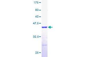 RPLP2 Protein (AA 1-115) (GST tag)